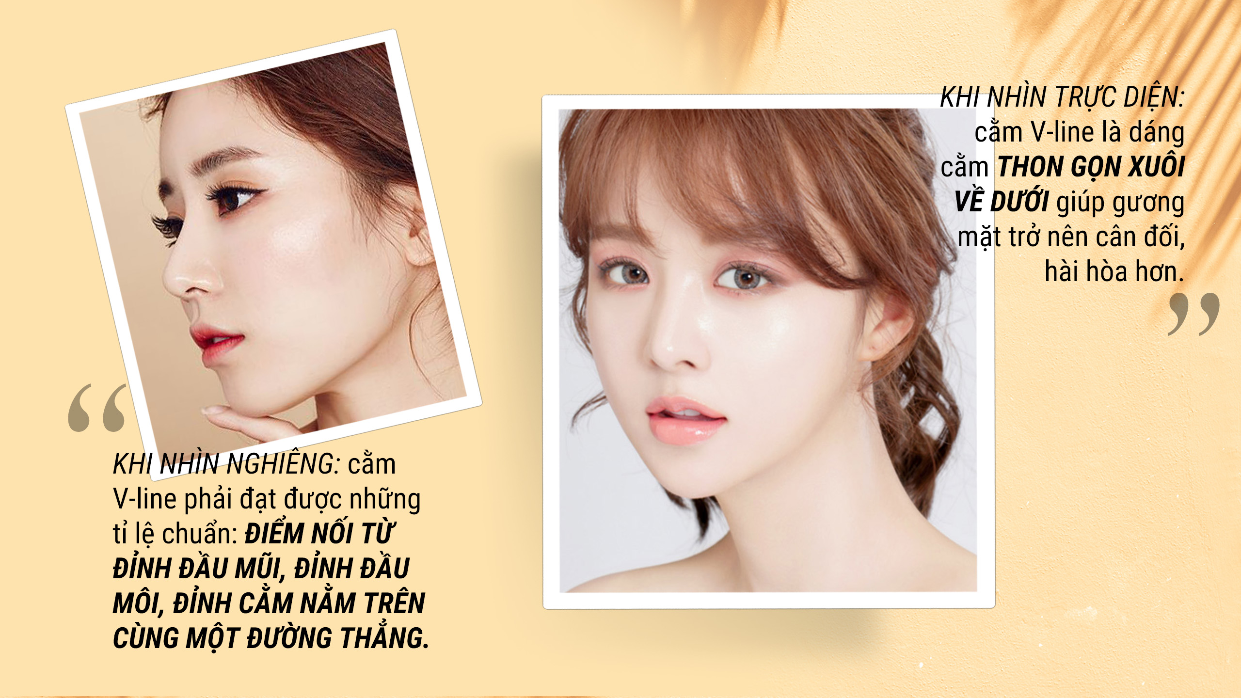 Tiêm filler tạo hình cằm