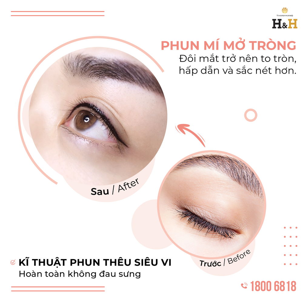 Dịch vụ thêu mí