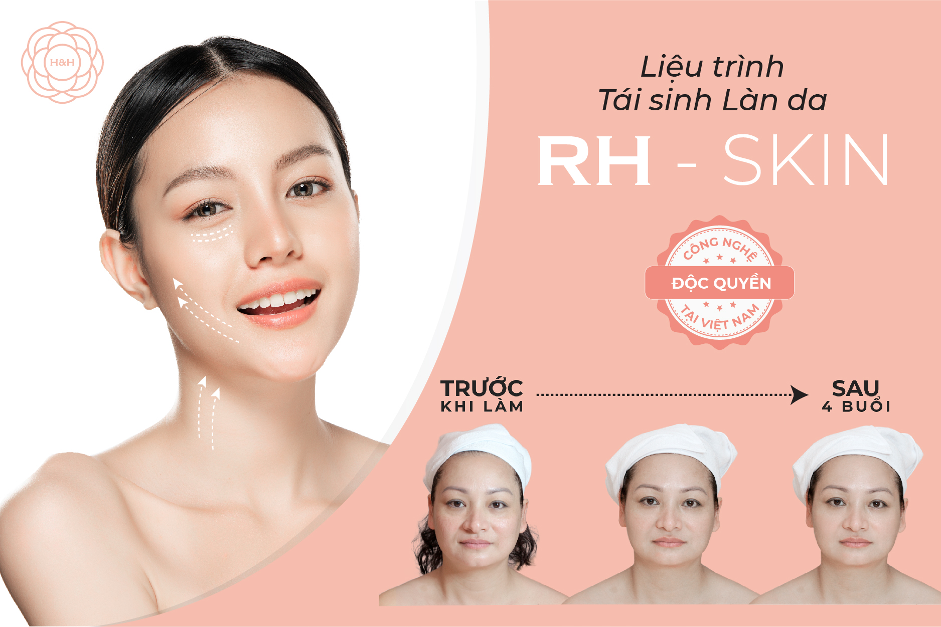 Tái sinh làn da RH Skin