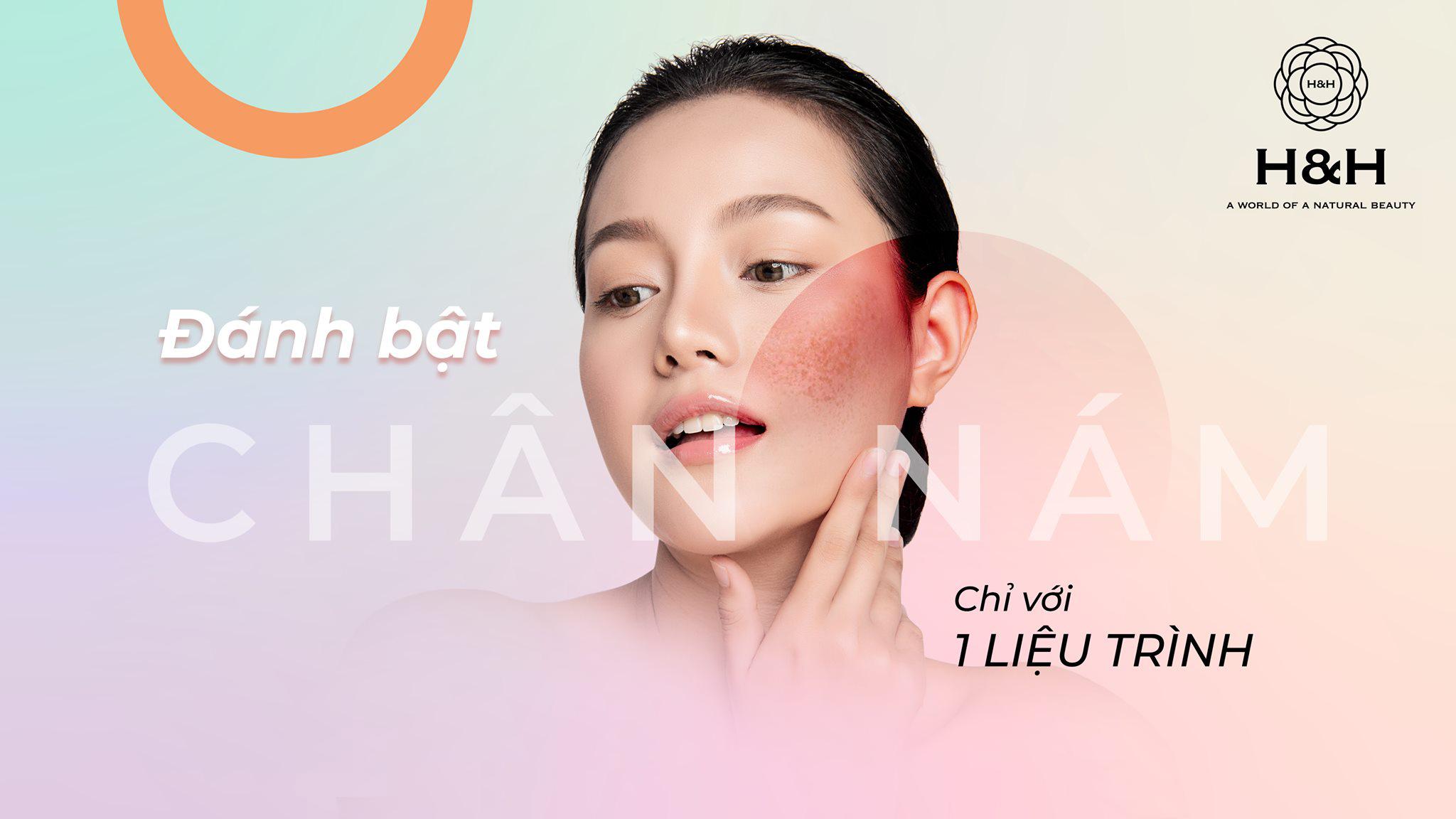 Laser trị nám/ tàn nhang