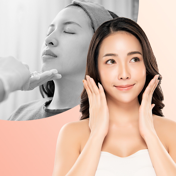 Tiêm filler tạo hình cằm